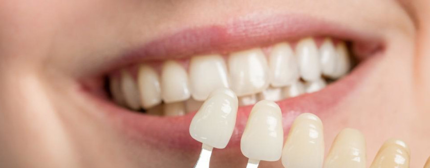 Diento Oral Health Care